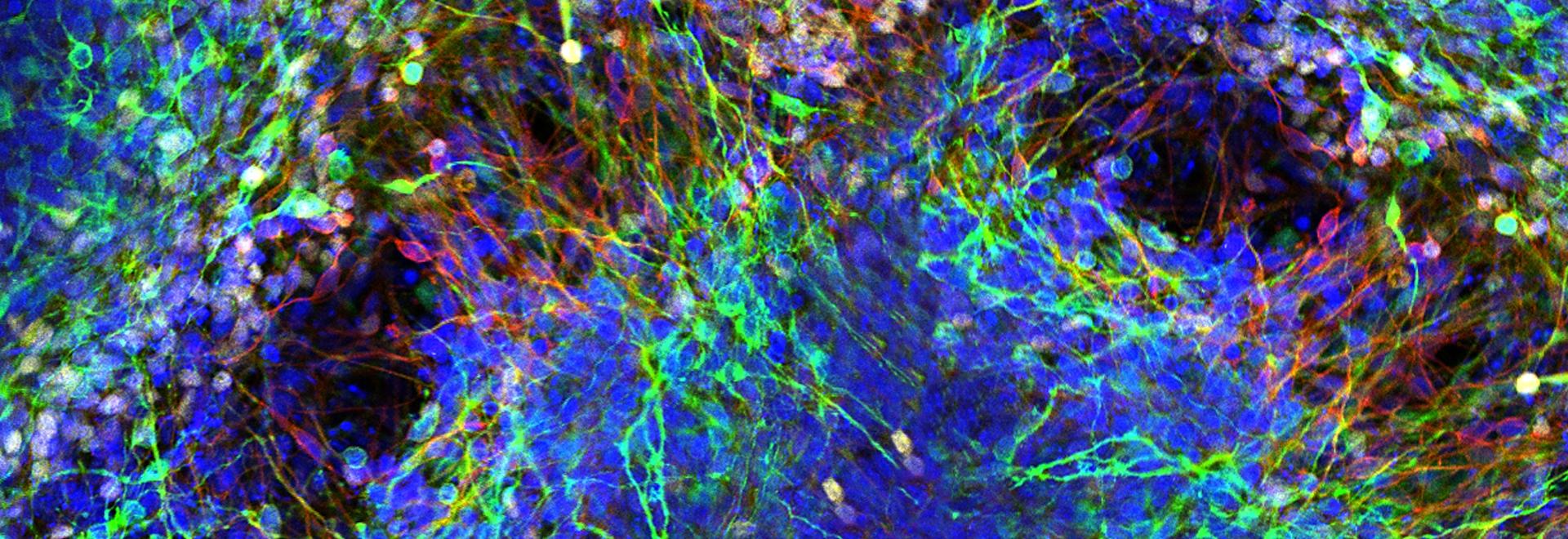 Confocal image of hESC derived neuron.