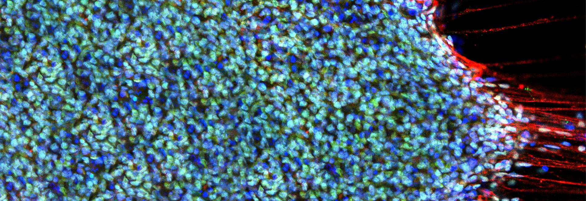 Research banner Image of fluorescent cells from a microscope