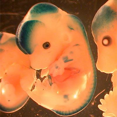 Embryo image provided by Jeff Henderson