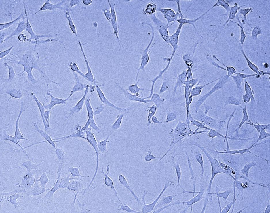 Cultured patient-derived glioblastoma stem cells