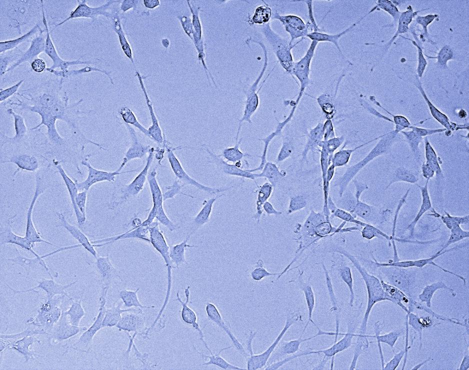 Cultured patient-derived glioblastoma stem cells