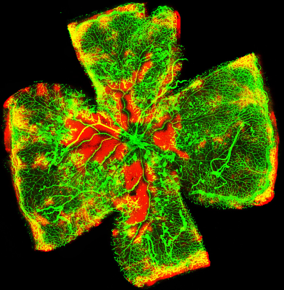 Animal-model retina with oxygen-induced retinopathy