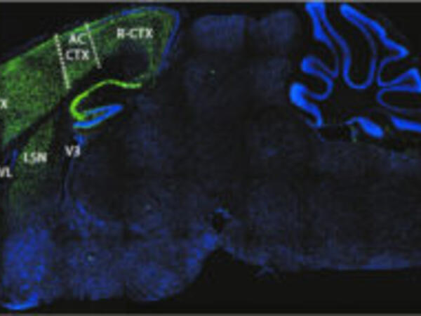 hampson_rodent_brain-300x143.jpg