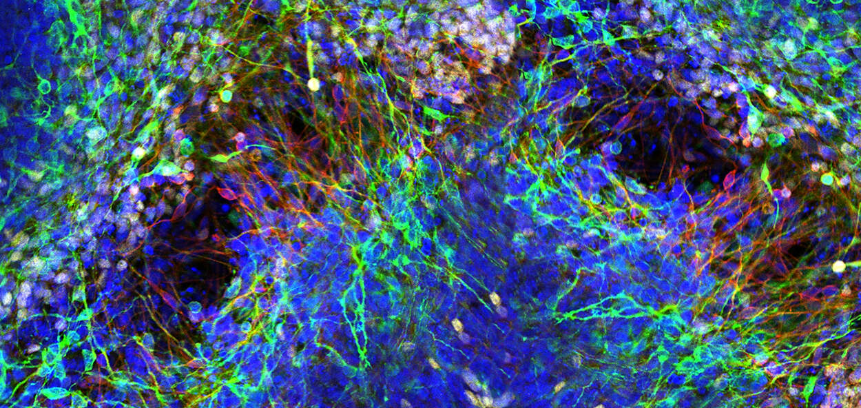 Confocal image of hESC derived neuron.