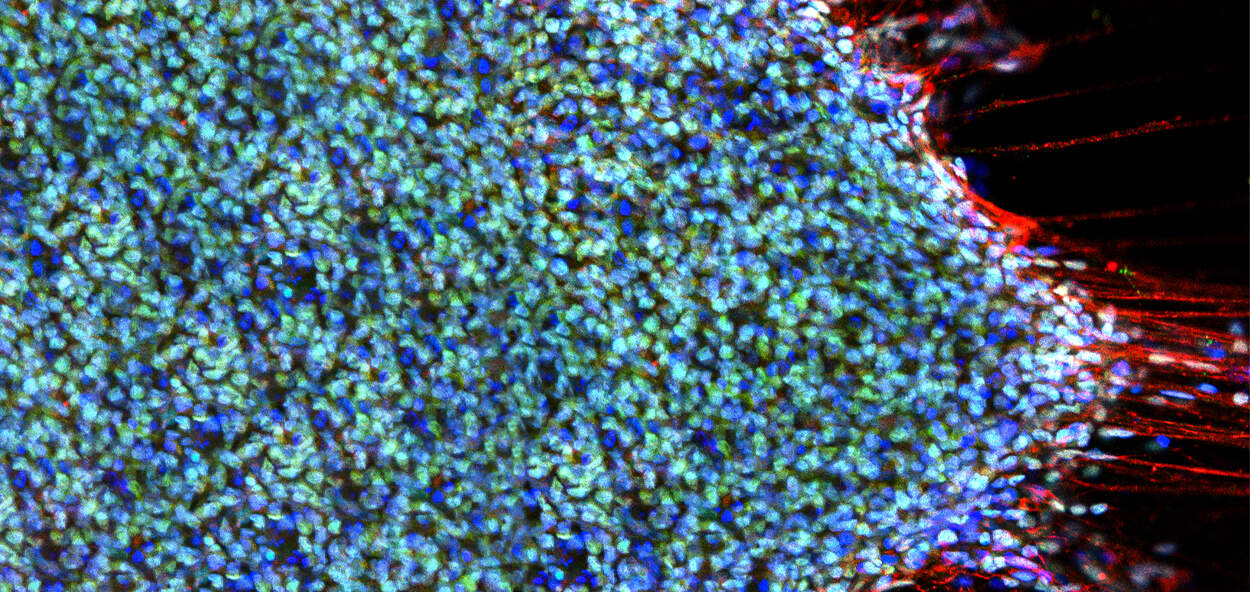 Research banner Image of fluorescent cells from a microscope