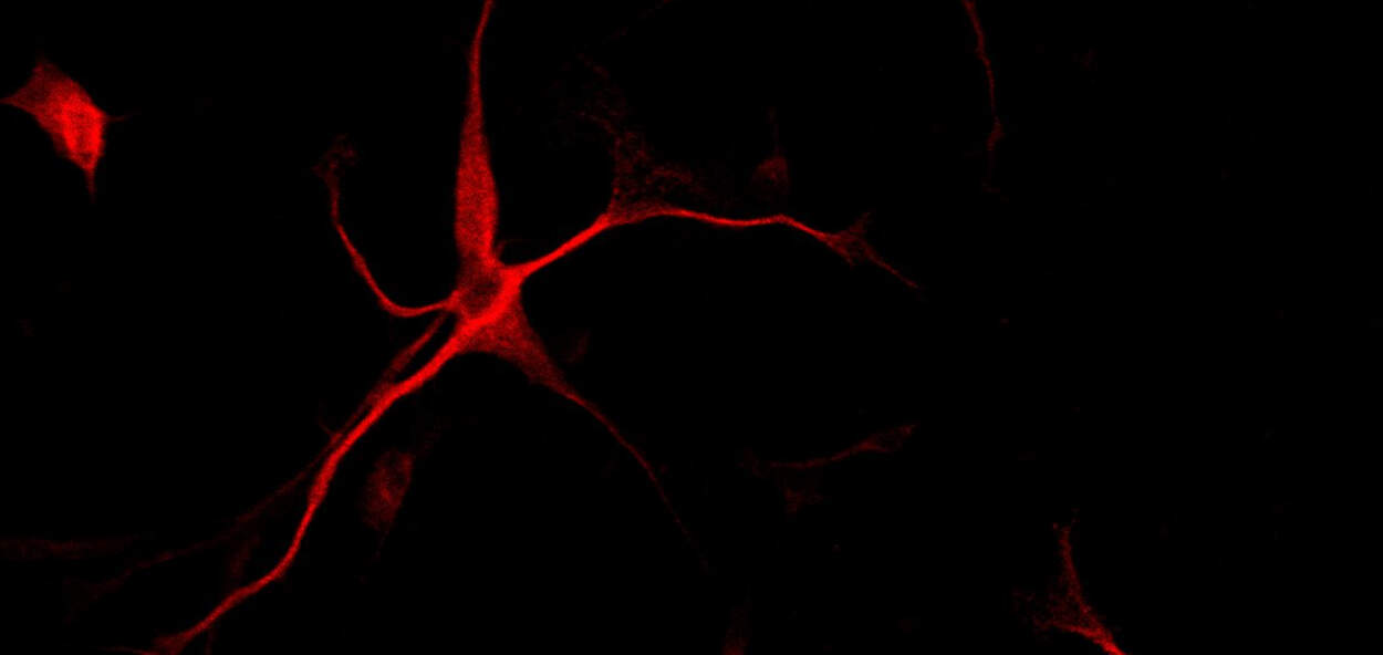 Proliferating brain cancer cells converted to non-proliferating neuronal cells  by some drug treatments resulting in inhibition of brain tumor cell growth