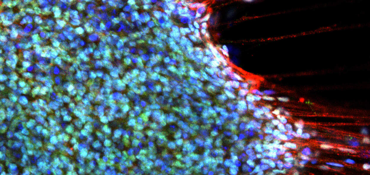 Fluorescent microscopy image showing a dense cluster of cells stained in shades of blue and green